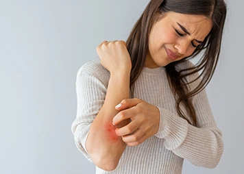 Psoriasis: The Skin Condition India Keeps Mistaking for Something Else